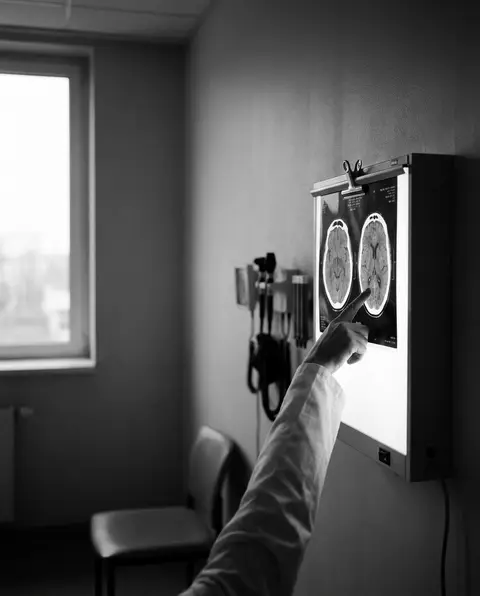 Brain CT scan displayed on a backlit radiology viewer